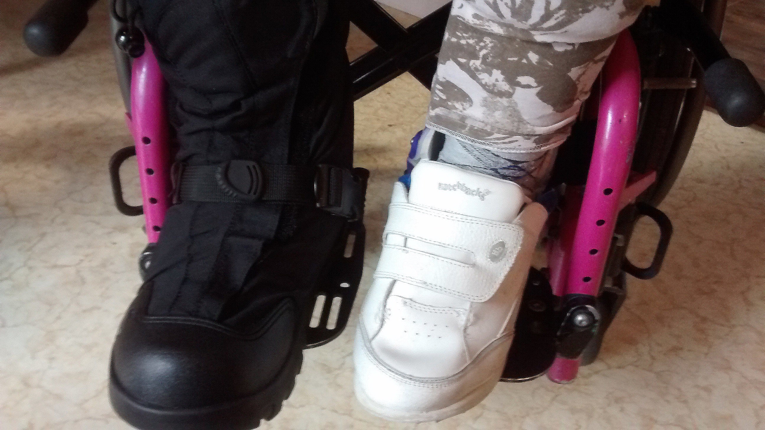NEOS for Prosthetics, Orthotics, Braces & Casts